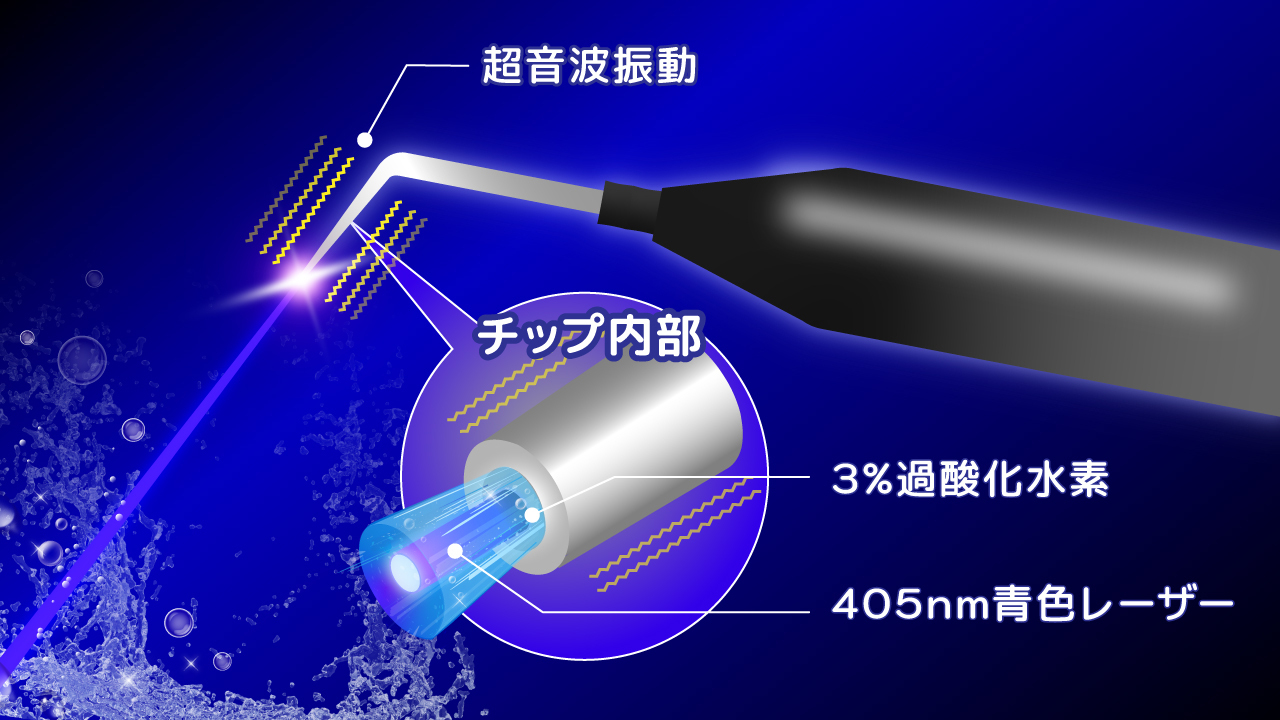 5．チップの構造